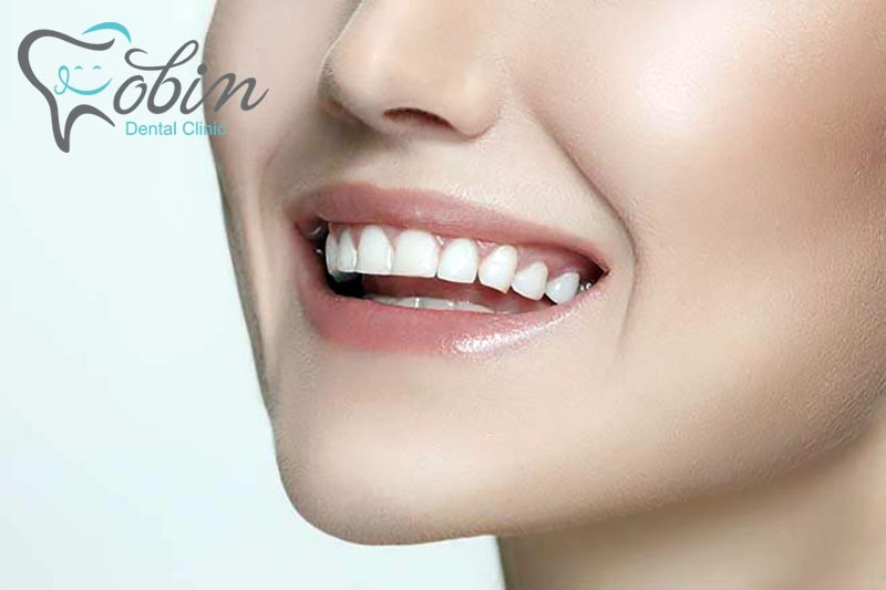 بلیچینگ دندان یکی از خدمات دندانپزشکی زیبایی است
